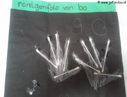 Knutselen Röntgenfoto